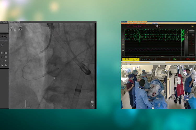 телемедицина, трансляция из операционной